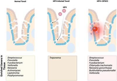 Mechanisms of crosstalk between the oropharyngeal microbiome and human papillomavirus in oropharyngeal carcinogenesis: a mini review